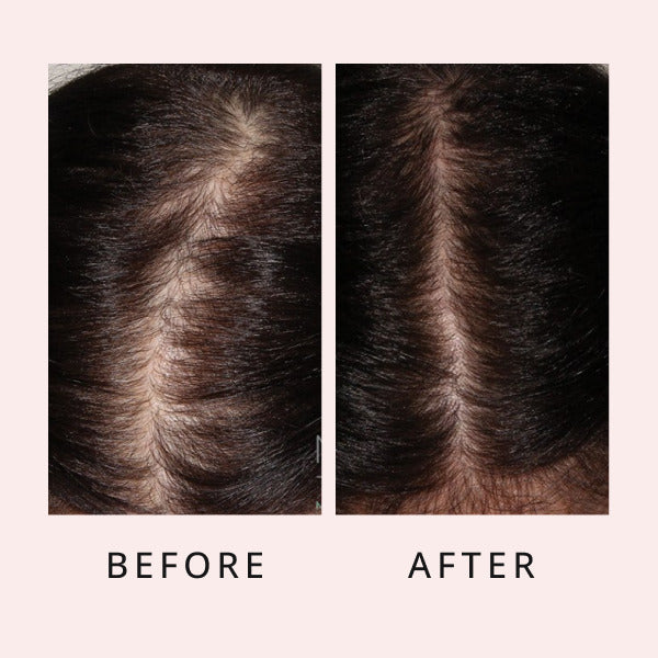 Sérum de luxe pour la croissance des cheveux, sérum pour la croissance des cheveux, sérum de croissance, sérum capillaire
