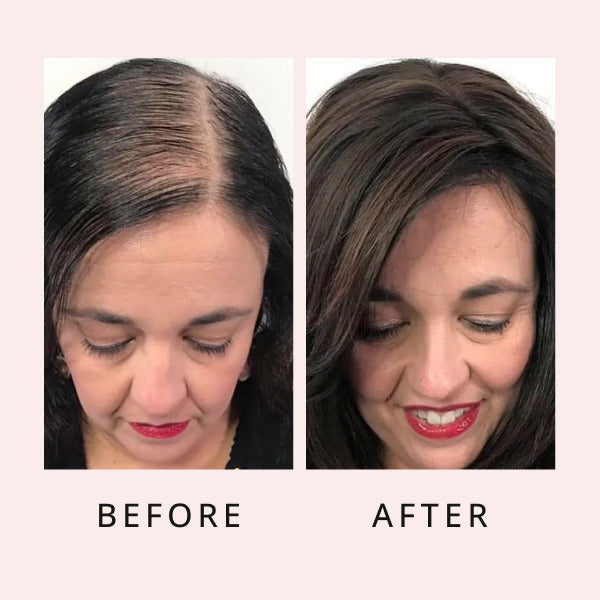 Sérum luxueux pour la pousse des cheveux, sérum pour la pousse des cheveux, sérum de pousse, sérum capillaire