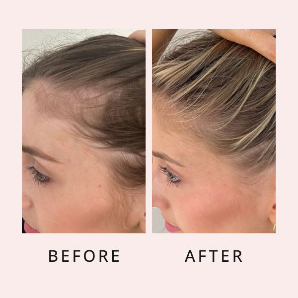 sérum luxueux pour la pousse des cheveux avant et après