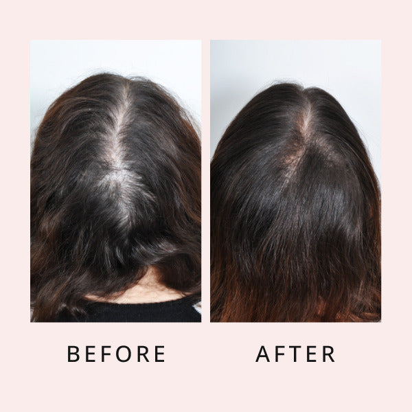 sérum luxueux pour la pousse des cheveux avant et après