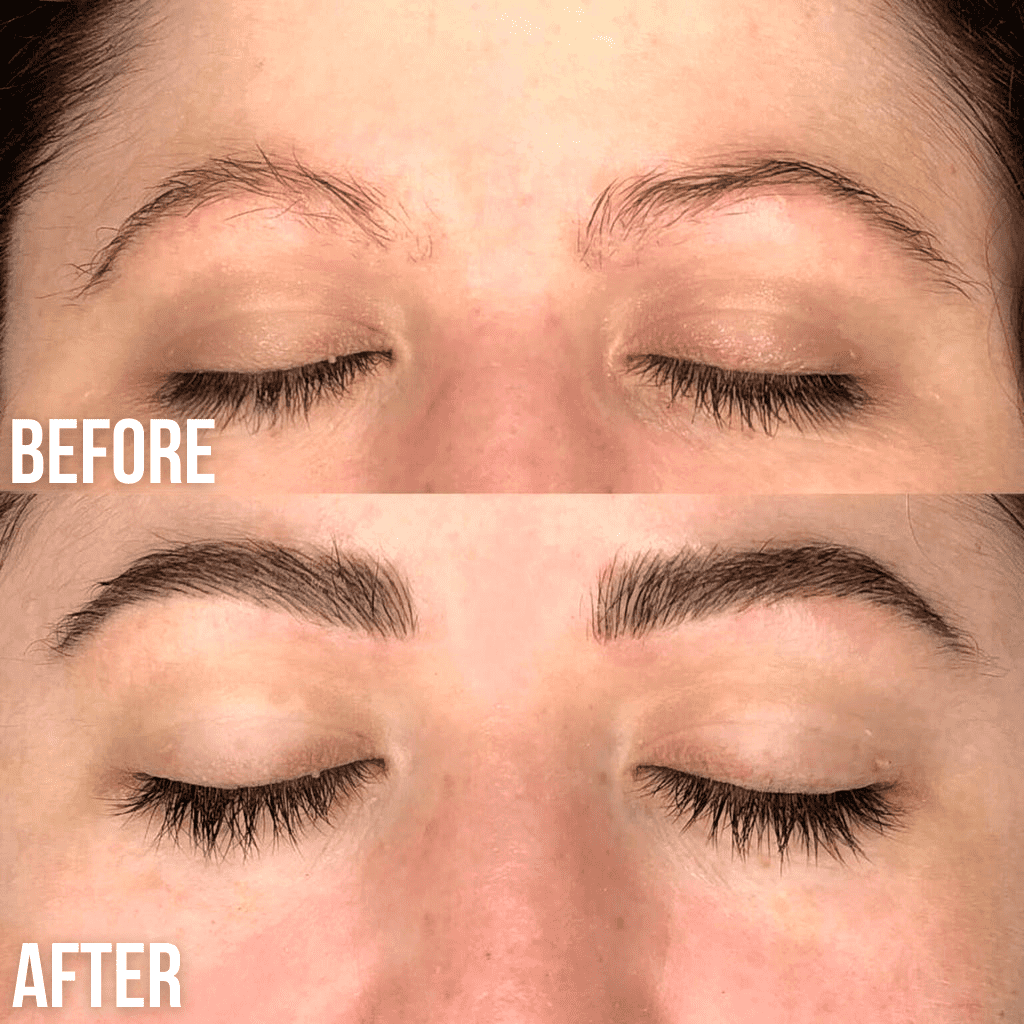 lifting des sourcils
