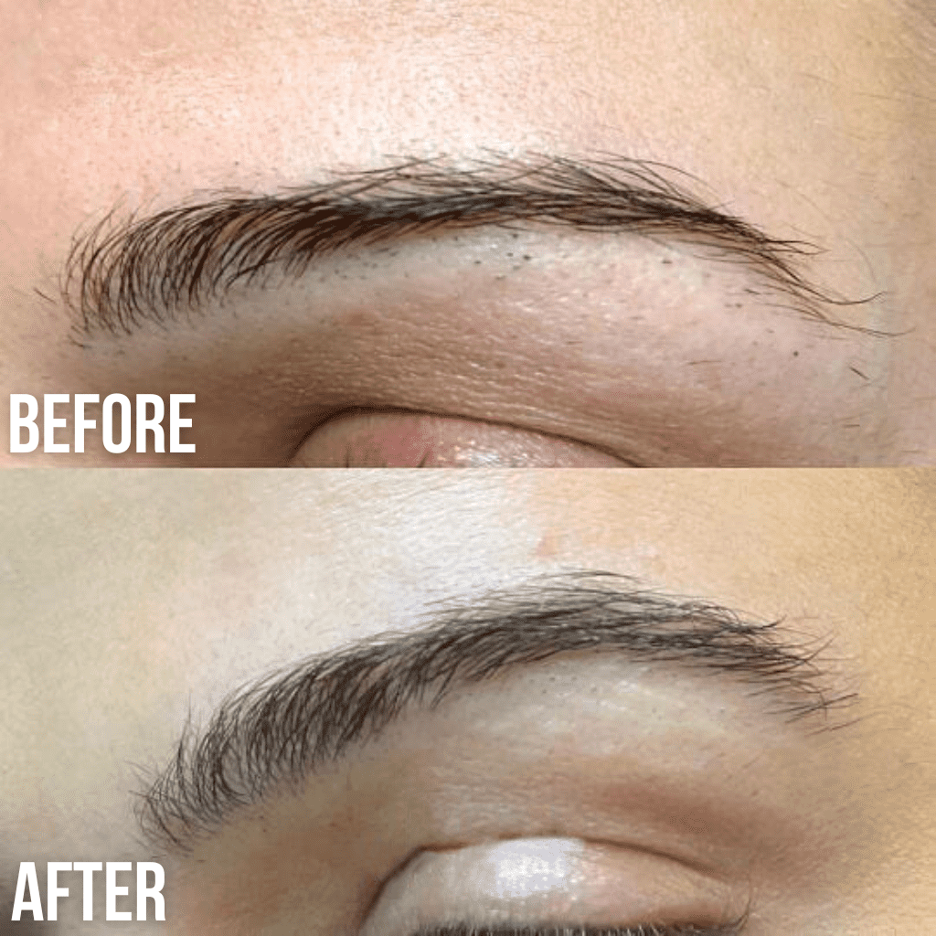 lifting des sourcils