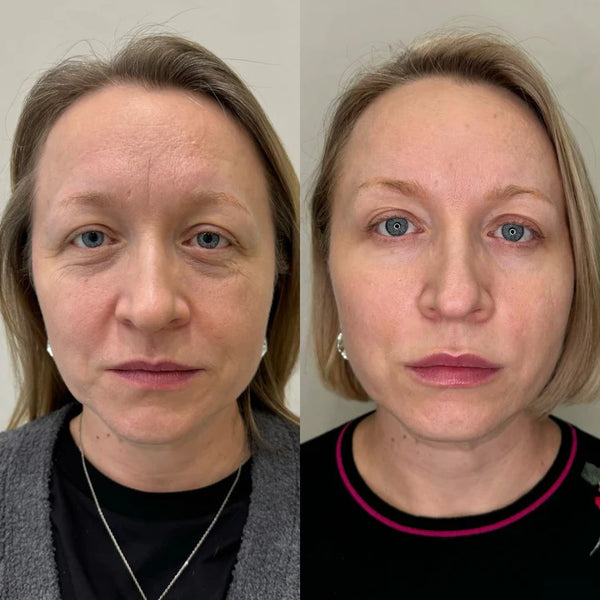 Carol A., 63 ans