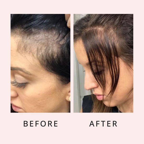 Sérum luxueux pour la pousse des cheveux, sérum de pousse des cheveux, sérum de croissance, sérum capillaire