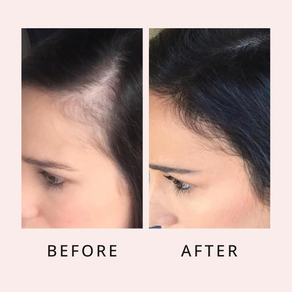Sérum luxe pour la pousse des cheveux, sérum pour la pousse des cheveux, sérum de croissance, sérum capillaire